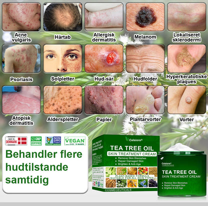 ✅Celsiora® Hudbehandlingscreme med tea tree-olie : Fjerner hudpletter, reparerer beskadiget hud, oplyser huden & anti-aging pleje ❤️‍🔥